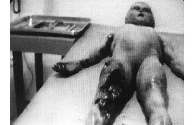 Santilli-alien-autopsy