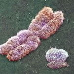 A photomicrograph shows an X chromosome at left, alongside a shrunken Y chromosome. The Y chromosome is passed down exclusively from father to son and can serve as an indicator of male-line human diversity. Crédito: Universidade de Arizona